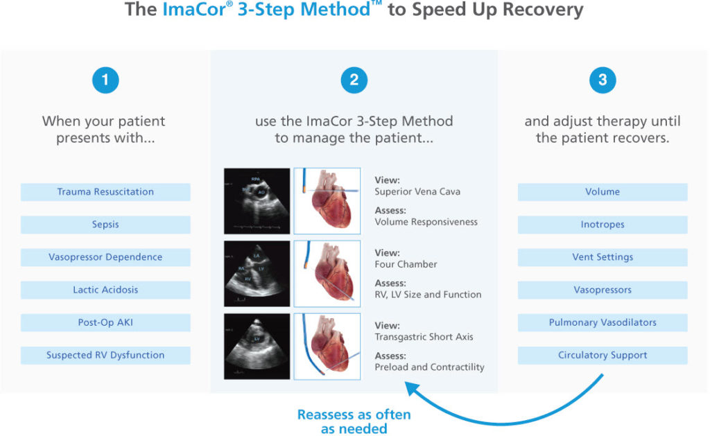 Hemodynamic Ultrasound for ICU | ImaCor