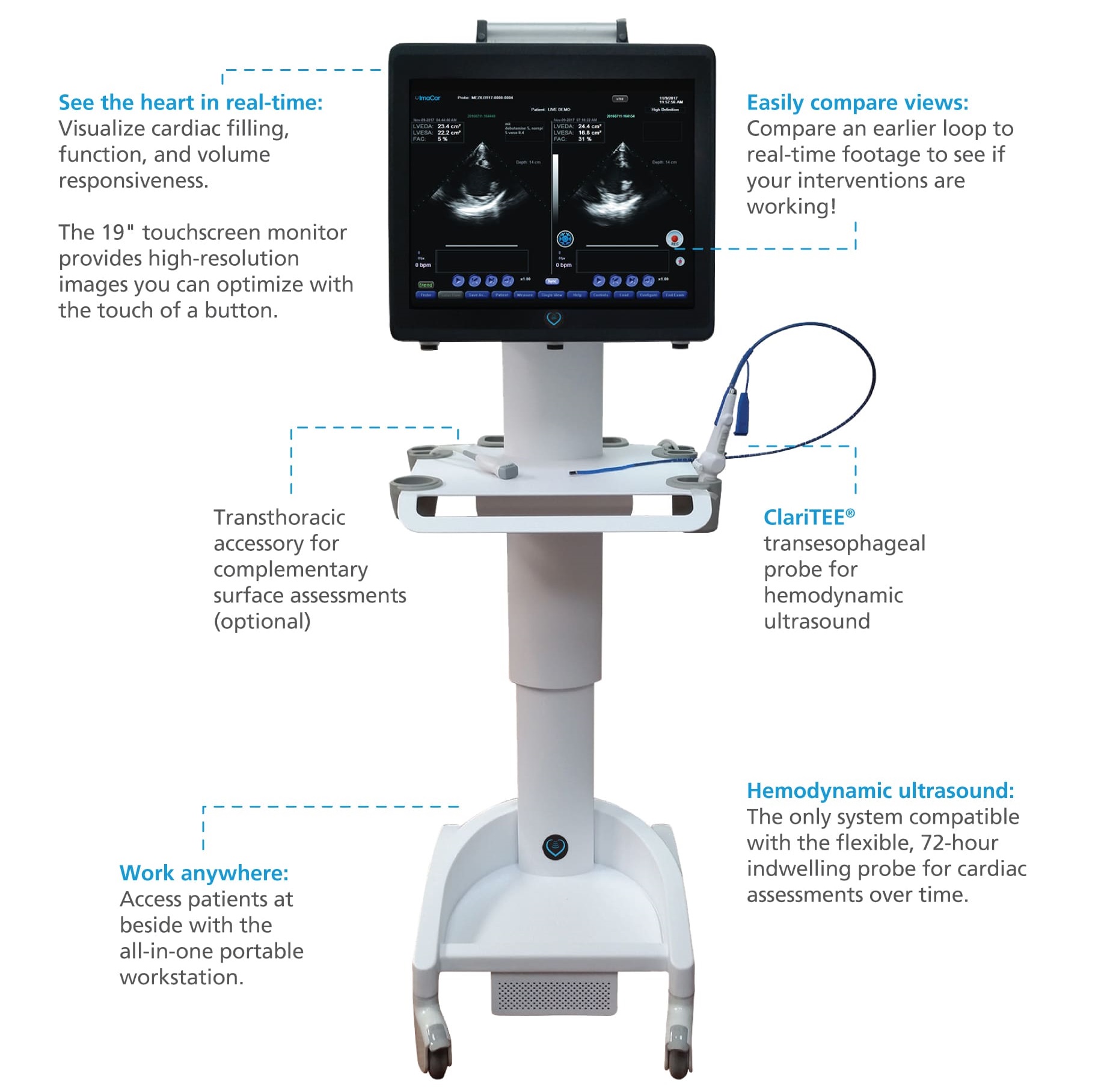 EVO 1 - Hemodynamic Ultrasound for ICU | ImaCor