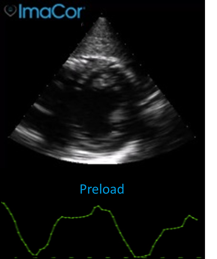 Hemodynamic Ultrasound for ICU | ImaCor