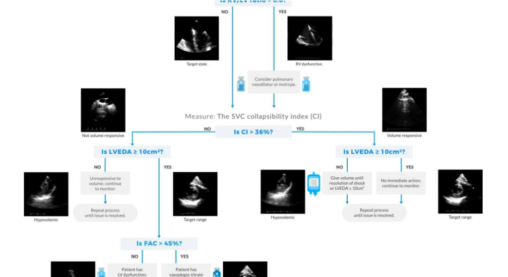 Hemodynamic Ultrasound for ICU | ImaCor