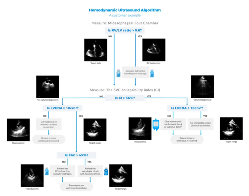 Hemodynamic Ultrasound for ICU | ImaCor